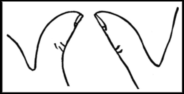 Thumb Position