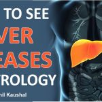 HOW TO SEE LIVER DISEASES IN ASTROLOGY