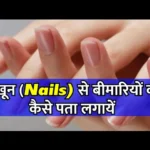  नाखून (Nails) से बीमारियों का कैसे पता लगायें|