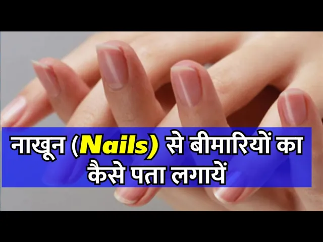  नाखून (Nails) से बीमारियों का कैसे पता लगायें|